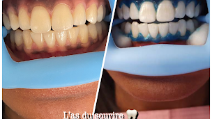 Photo n°1 de L'as du sourire à Gagny (Service de blanchiment des dents)