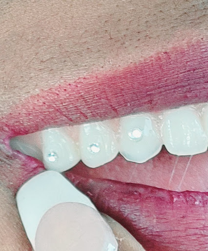 Eclipse Teeth Whitening & Gems Logo