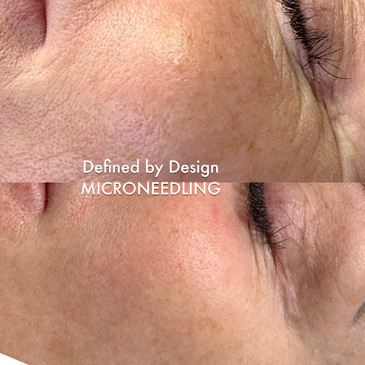 Defined by Design - Skincare + Lash Extensions - Thumbnail
