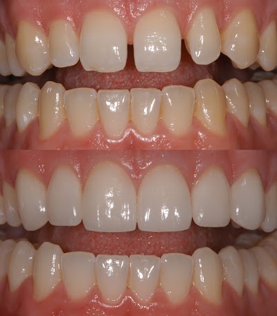 Photos of Dr. Rezaei Cosmetic Dentistry
