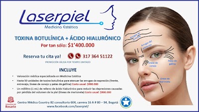 Photos of Laserpiel
