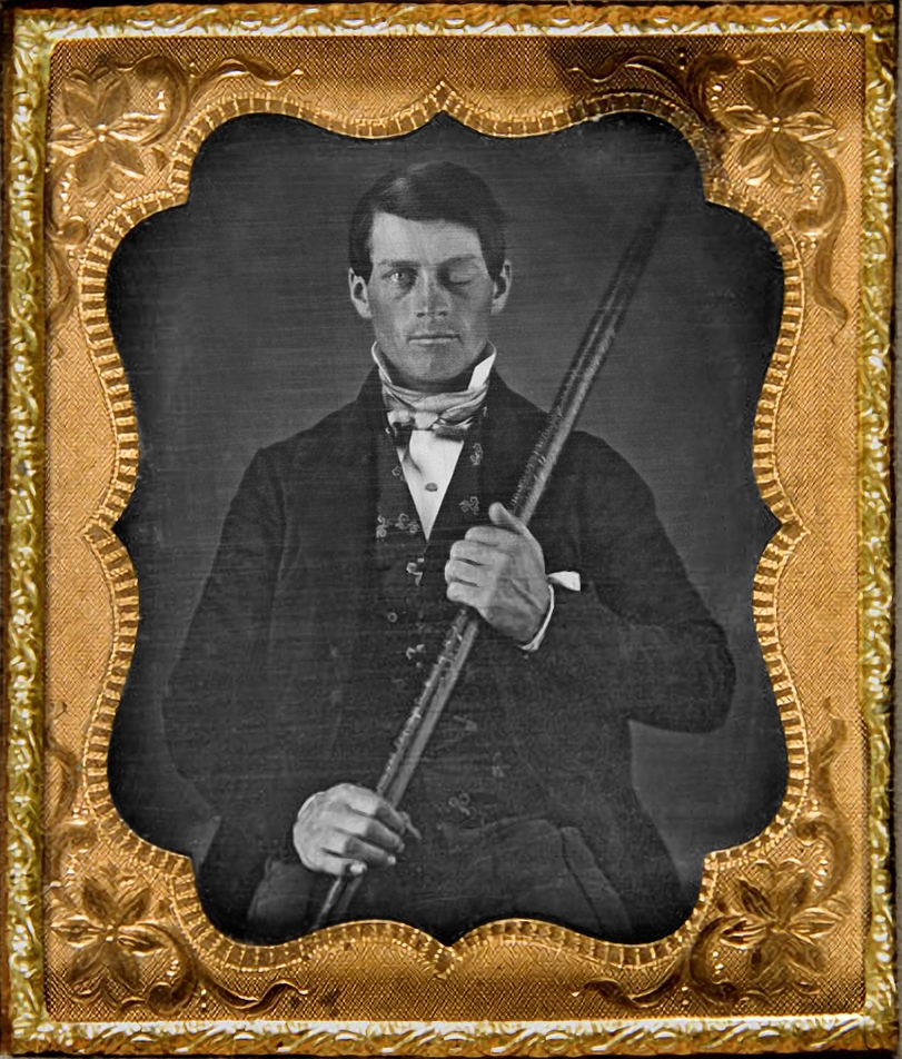 Phineas Gage, a modern miracle