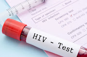 Many people with serious psychological illnesses who are HIV-positive die because they don’t get or stay on treatment. Stock photo. 