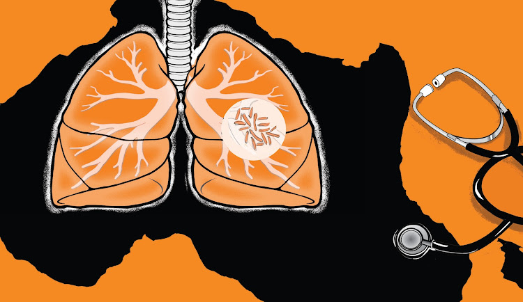 TB in Africa. Without proper treatment up to two thirds of the sick people will die, according to the World Health Organization.