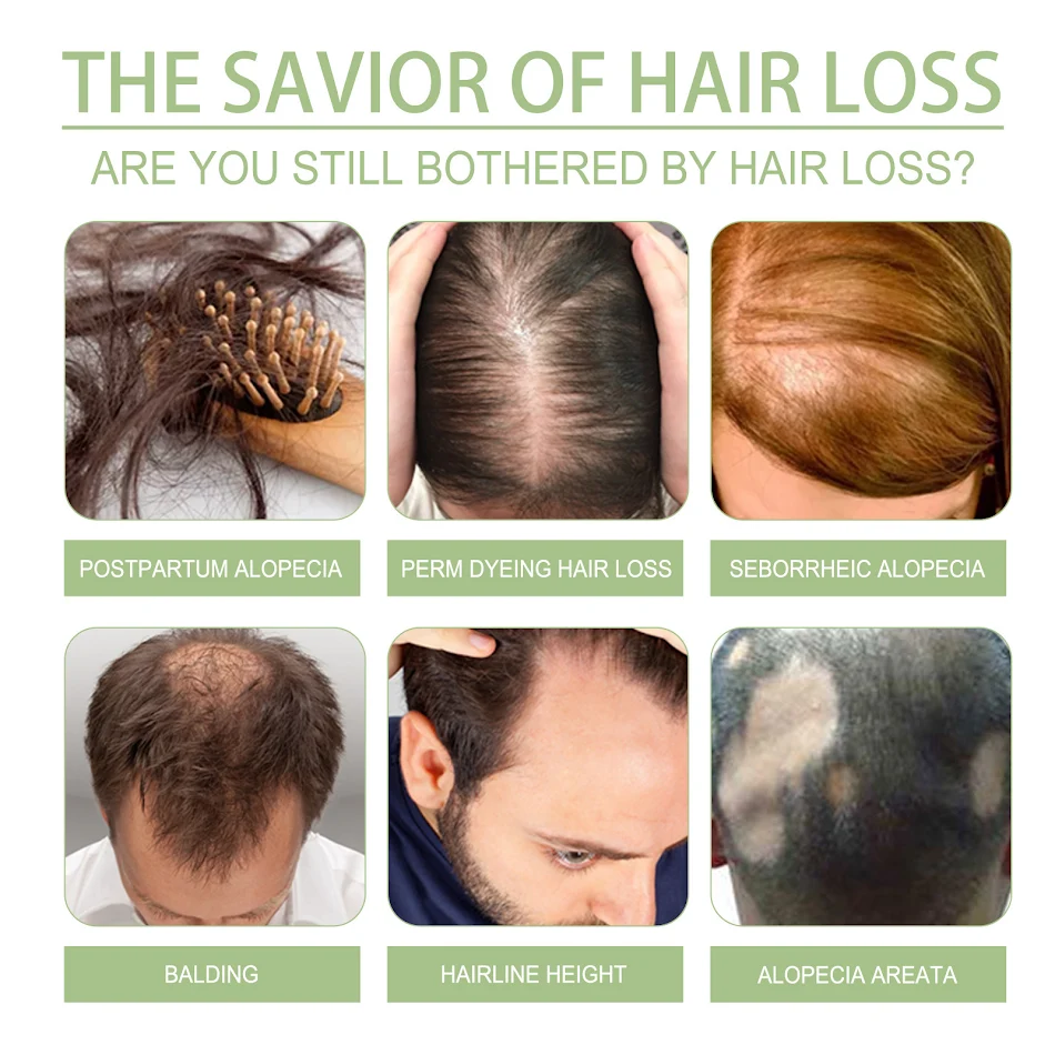 Óleo Capilar Herbal Denso Anticaída Repara Couro Cabeludo Fortalece o Cabelo Macio e Suave Crescimento Capilar Saudável e Denso