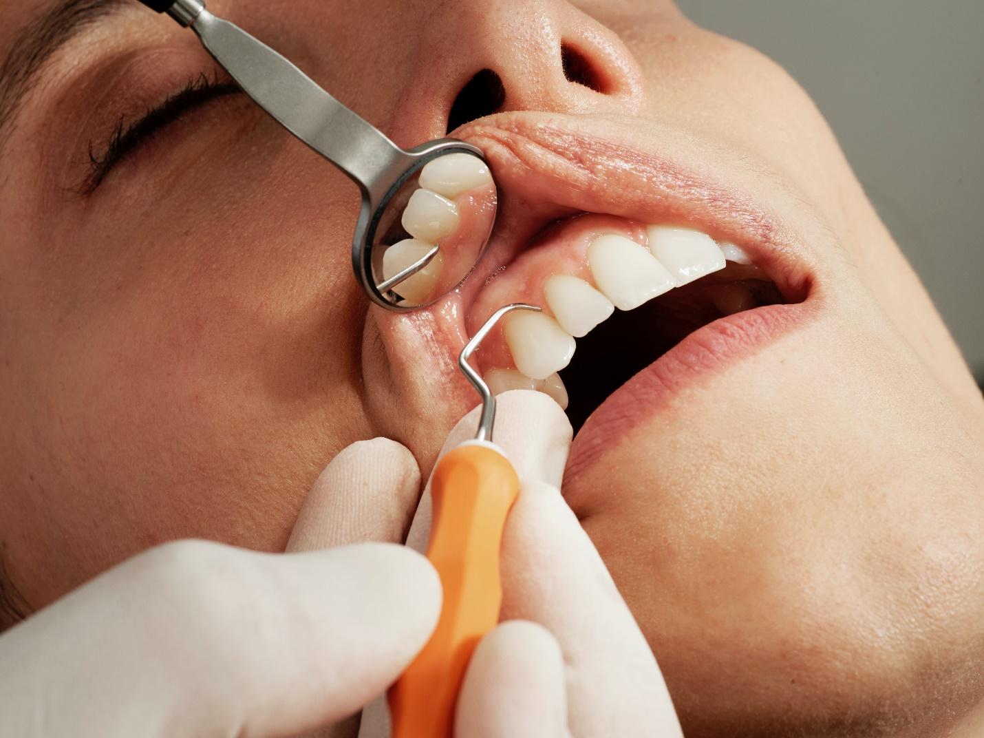 A dentist examining a patient's teeth

Description automatically generated with medium confidence