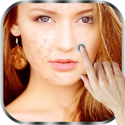 Pimple Remover Photo Editor  Icon