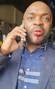 DA Gauteng leader Solly Msimanga was beaten to a pulp on Thursday.