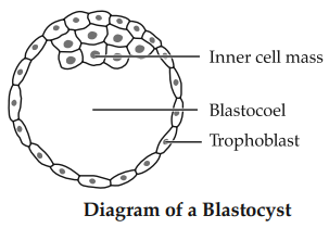 Solution Image