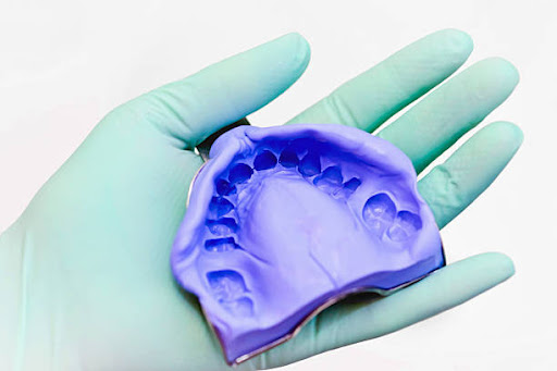 Why Would A Dentist Request Preliminary Impressions
