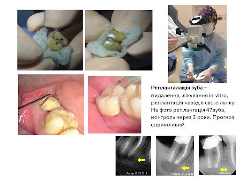 Стоматологія Др.Ірена Пшик-Тітко, к.мед.н. Dental private practice. Dr. Irena Pshyk-Titko PhD