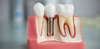 Dental Studio - стоматология Днепр: полный спектр стоматологических услуг в Днепре по низким ценам