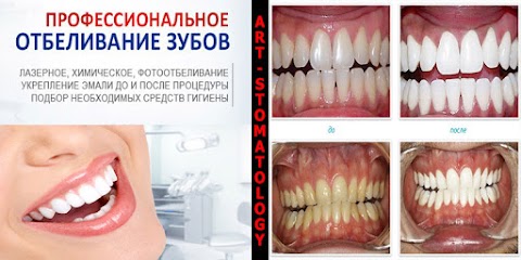 Art Stomatology стоматология в Одессе