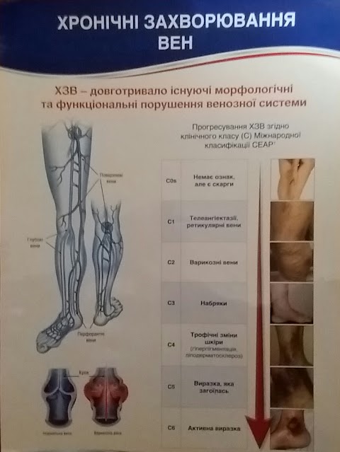 Центр Гирудотерапии -Лечение пиявками- Сумы