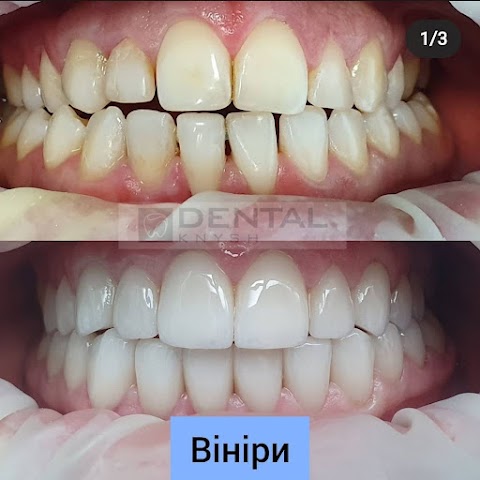 Стоматологія DentalKnysh