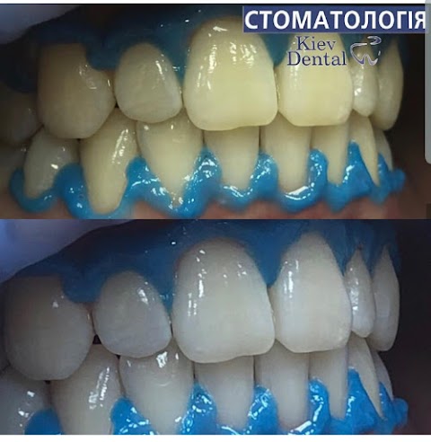 Стоматологія Kiev Dental