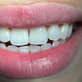 Dentis Line