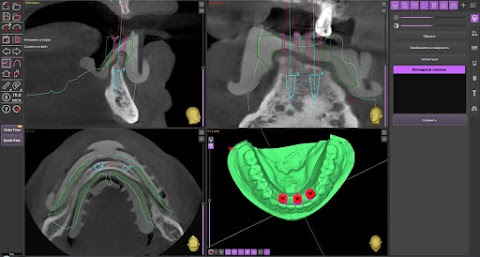 ProDigiDent