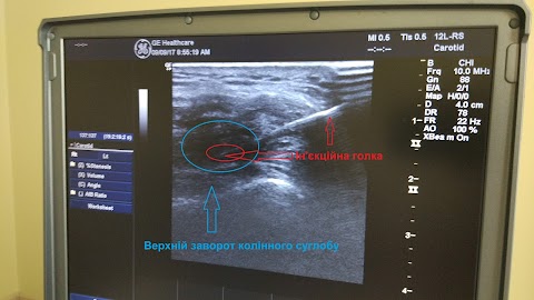 Achilles травматологія та ортопедія