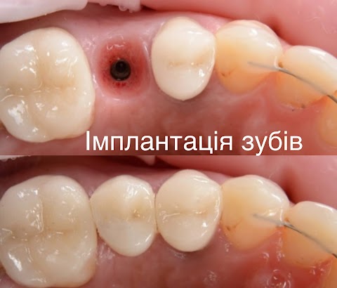 Стоматологія Crystal Dental Studio by dr. Vyzhu