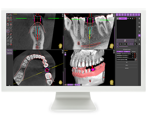 ProDigiDent