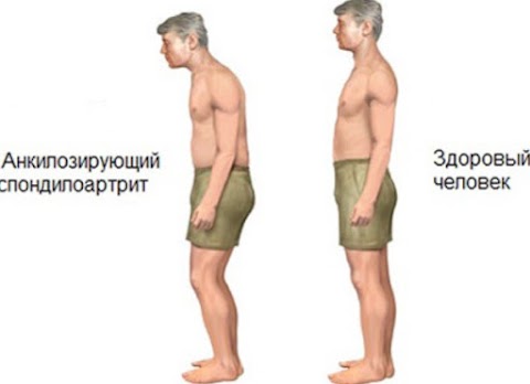 Сташкевич Анатолий Трофимович (лечение заболеваний позвоночника)