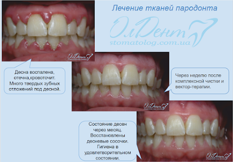 ОЛДЕНТ стоматологическая клиника