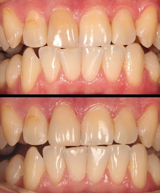 Стоматологія Збереження зубів