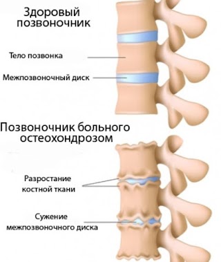 Сташкевич Анатолий Трофимович (лечение заболеваний позвоночника)