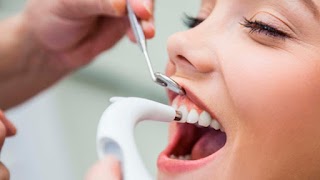 Клиника Denta-Pro. Стоматолог, ортодонт. Брекеты, виниры, импланты в Днепре