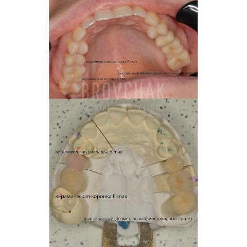 Стоматология Brovchak Dental Clinic Голосеево, Демиевка, Васильковская. Лечение зубов под микроскопом Киев. Отбеливание и чистка зубов. Протезирование. Стоматолог Киев.