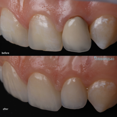 Центр стоматології Голобородько