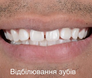 Стоматологія Crystal Dental Studio by dr. Vyzhu