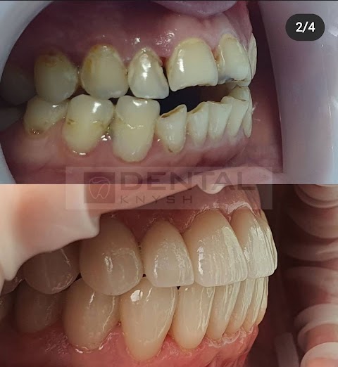 Стоматологія DentalKnysh