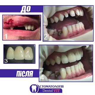 СтоматологіяDental VIT