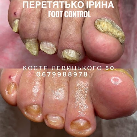 Центр нігтьової естетики та подології Foot Control