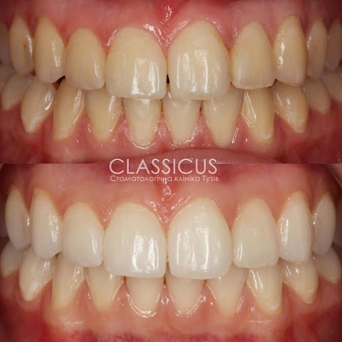 CLASSICUS - Tuz Dental Clinic