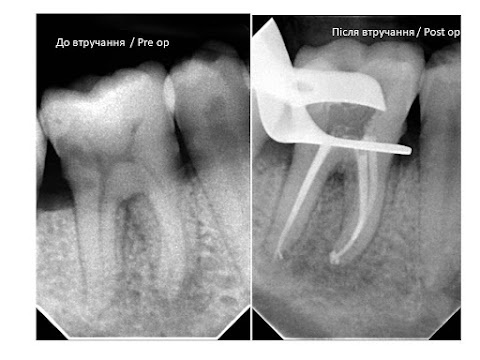 Стоматологія Др.Ірена Пшик-Тітко, к.мед.н. Dental private practice. Dr. Irena Pshyk-Titko PhD