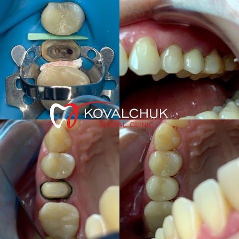 KOVALCHUK Dental Clinic