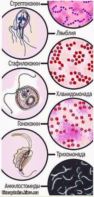 Аптека Киев - Лечение от паразитов