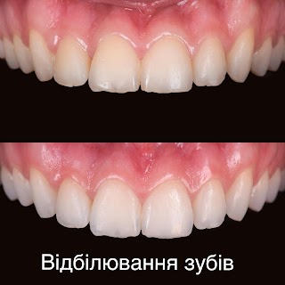 Стоматологія Crystal Dental Studio by dr. Vyzhu