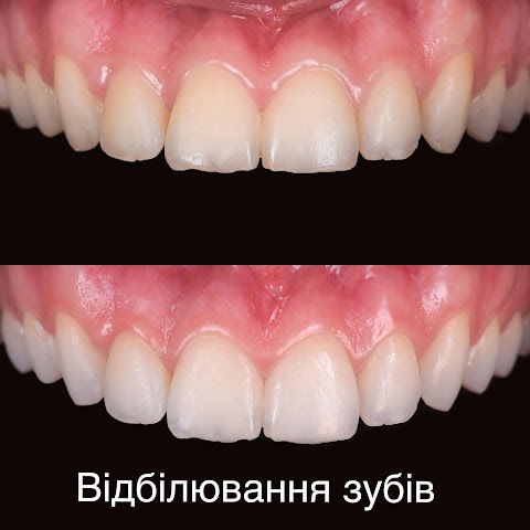 Стоматологія Crystal Dental Studio by dr. Vyzhu