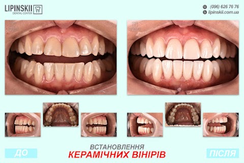 Стоматология дентал центр "Липинский"