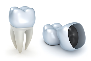 Стоматология | Dental-C | На Лесном | Протезирование зубов. Зубные коронки. Брекеты. Виниры.