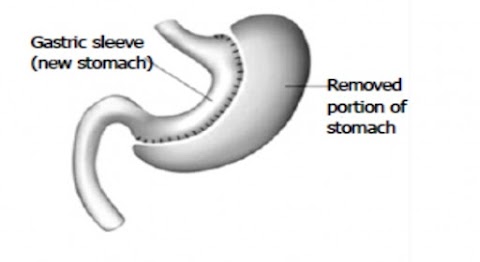 Dott. Gennaro Martines, Chirurgo generale,chirurgo bariatrico,proctologo, chirurgia laparoscopica,chirurgia colo-rettale,endoscopia digestiva diagnostica e operativa