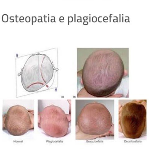 Dr. Michele Casillo - Osteopatia | Fisioterapia | Posturologia - FisiOsteo Lab