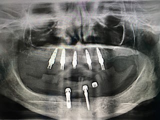 studio dentistico Dott.Mirco Di Biase