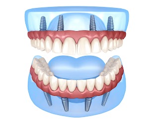 Dentista - Dottor Massimiliano Pollono