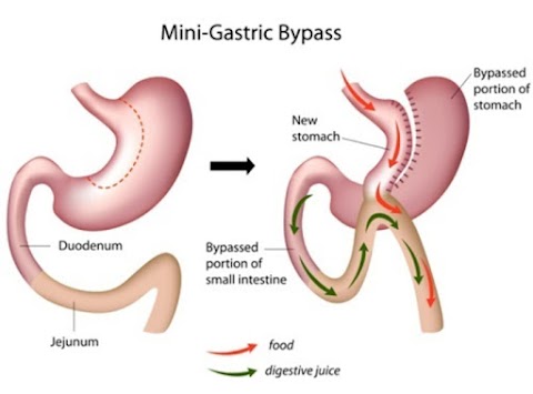 Dott. Gennaro Martines, Chirurgo generale,chirurgo bariatrico,proctologo, chirurgia laparoscopica,chirurgia colo-rettale,endoscopia digestiva diagnostica e operativa