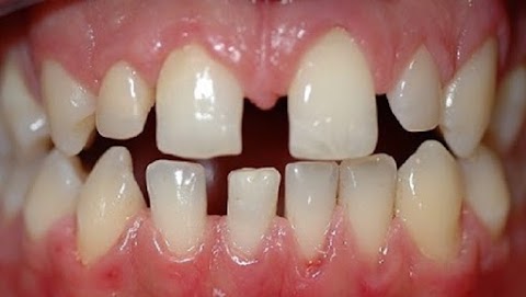 Studio Dentistico Associato Dott.ssa Caprari E. Dr. Bonometti M.